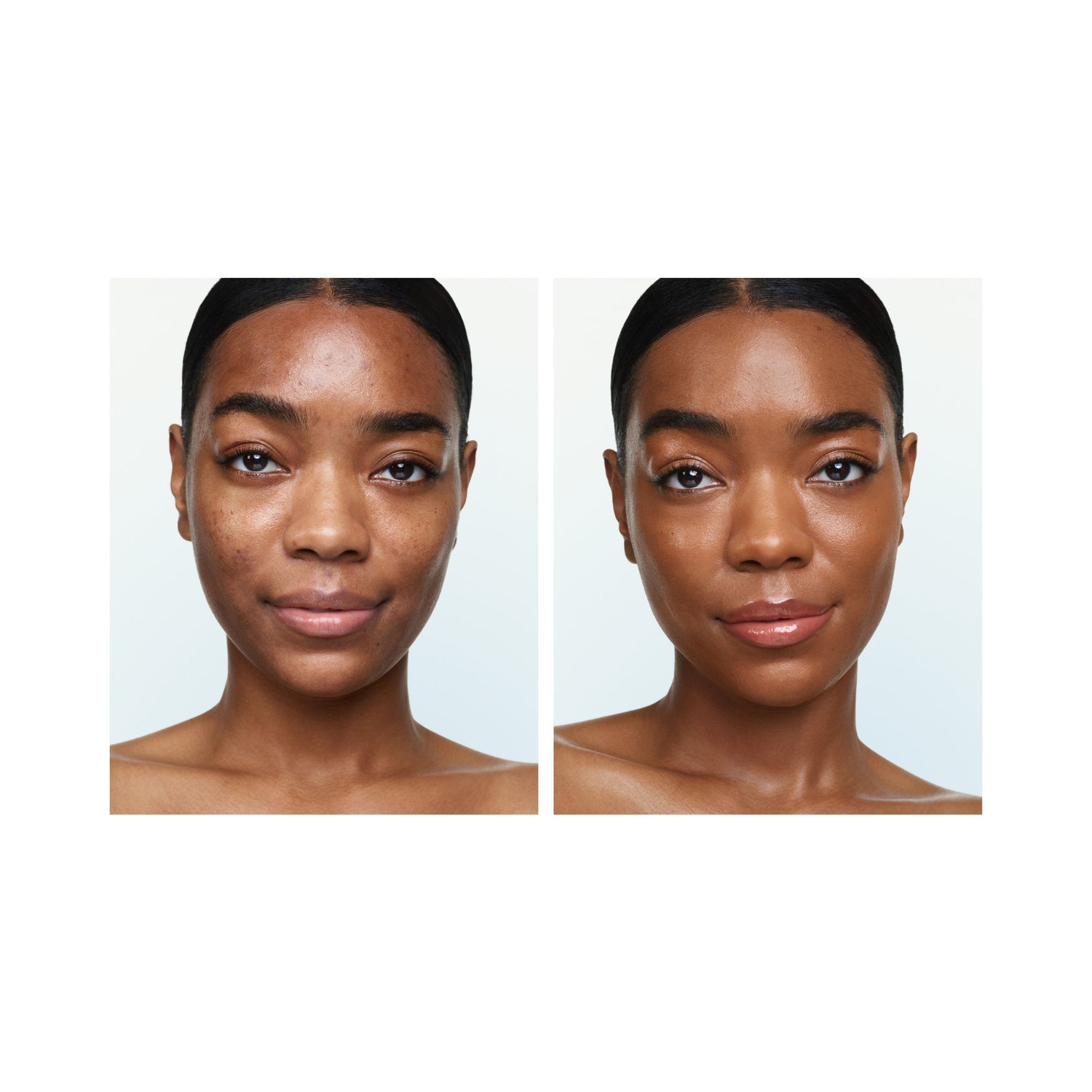 Before and after results of using U Beauty Super Tinted Hydrator variant: 09