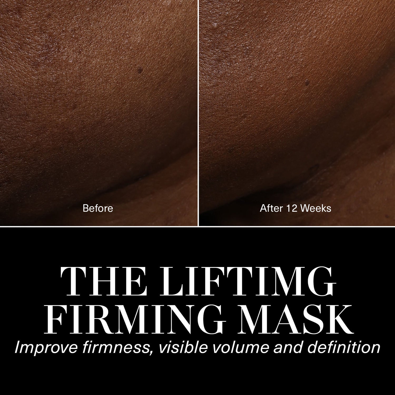 Before and after results of using La Mer The Lifting and Firming Mask variant: 1.7 fl oz