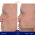 Before and after results of using Augustinus Bader The Retinol Serum variant: 1.7 oz