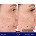 Before and after results of using Augustinus Bader The Retinol Serum variant: 1.7 oz