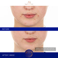 Before and after results of using Augustinus Bader The Retinol Serum variant: 1.7 oz