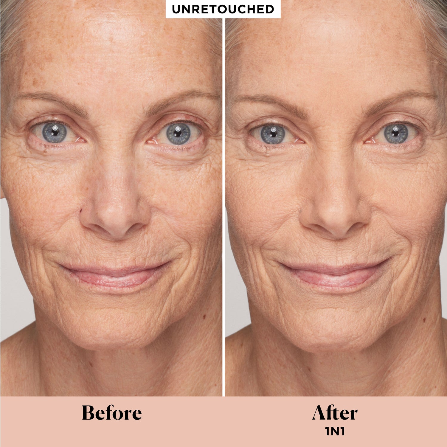Before and after results of using Laura Mercier Real Flawless Weightless Perfecting Concealer variant: 1N1