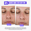 Kiehl's Since 1851 Clearly Corrective Dark Spot Solution Size variant: 1 Oz. before and after image 2 .