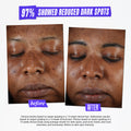 Kiehl's Since 1851 Clearly Corrective Dark Spot Solution Size variant: 1 Oz. before and after image 3 .