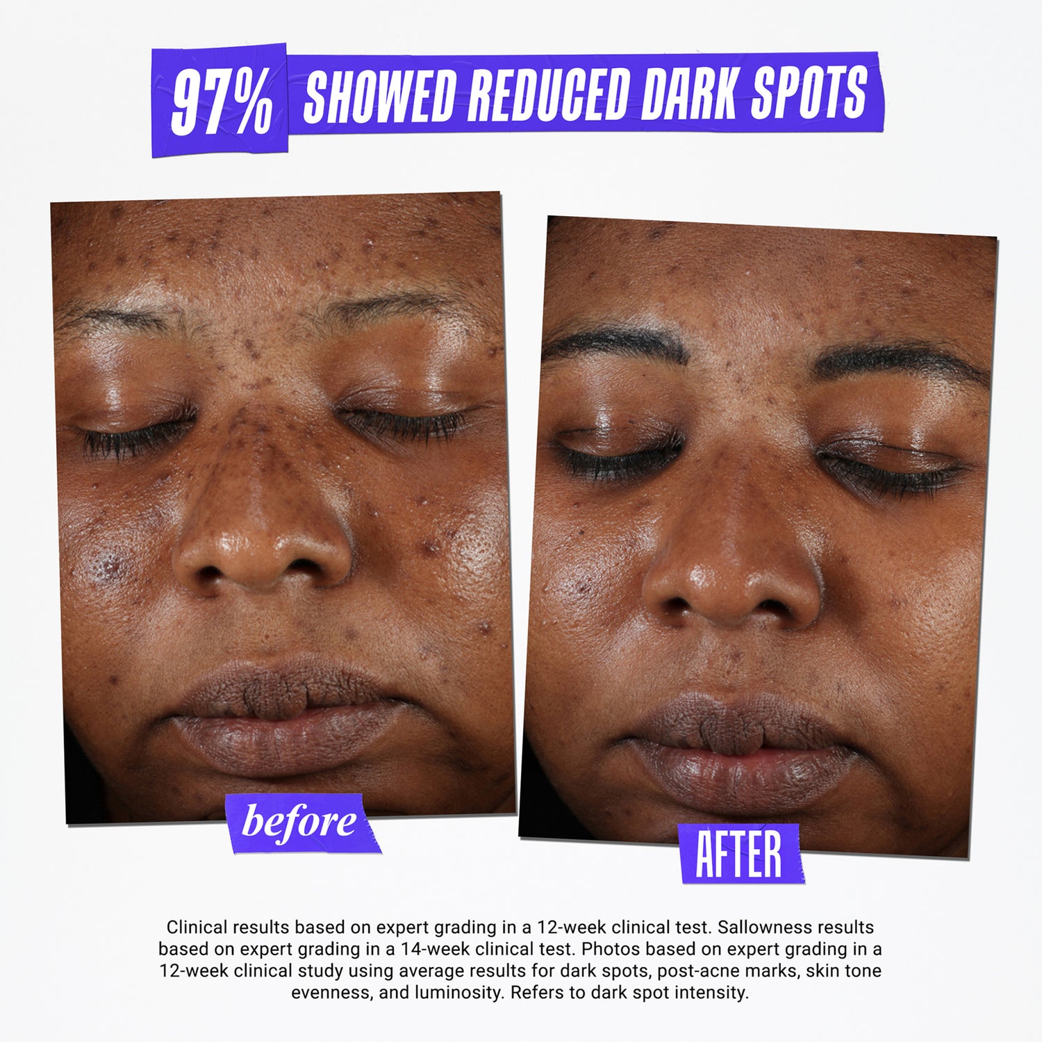 Kiehl's Since 1851 Clearly Corrective Dark Spot Solution Size variant: 1 Oz. before and after image 3 .