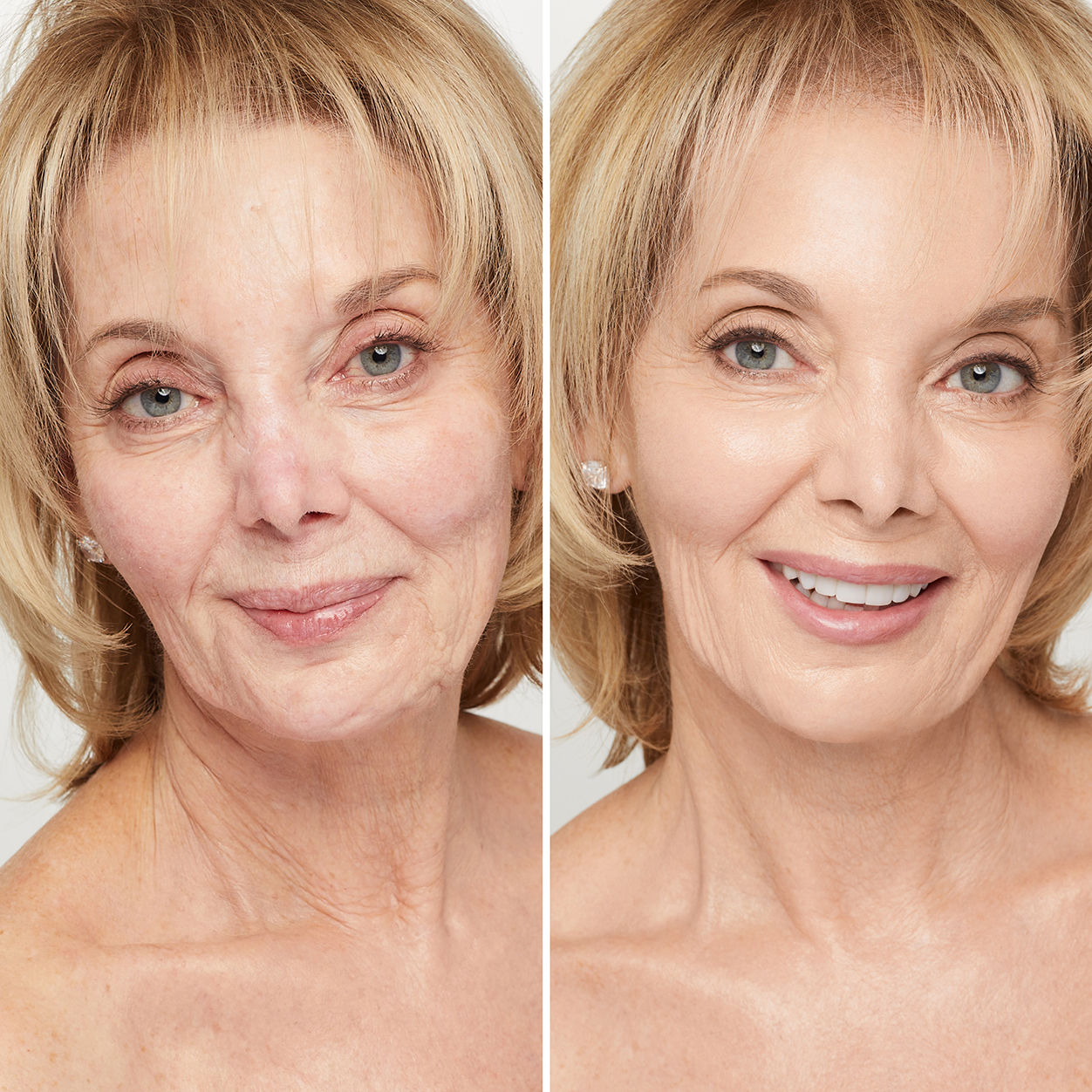 Before and after results of using Trish McEvoy Gorgeous Even Skin Foundation variant: 2FN - Fair with neutral undertones, for pale to fair skin