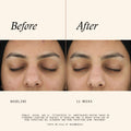 Before and after results of using   variant: 2 fl oz