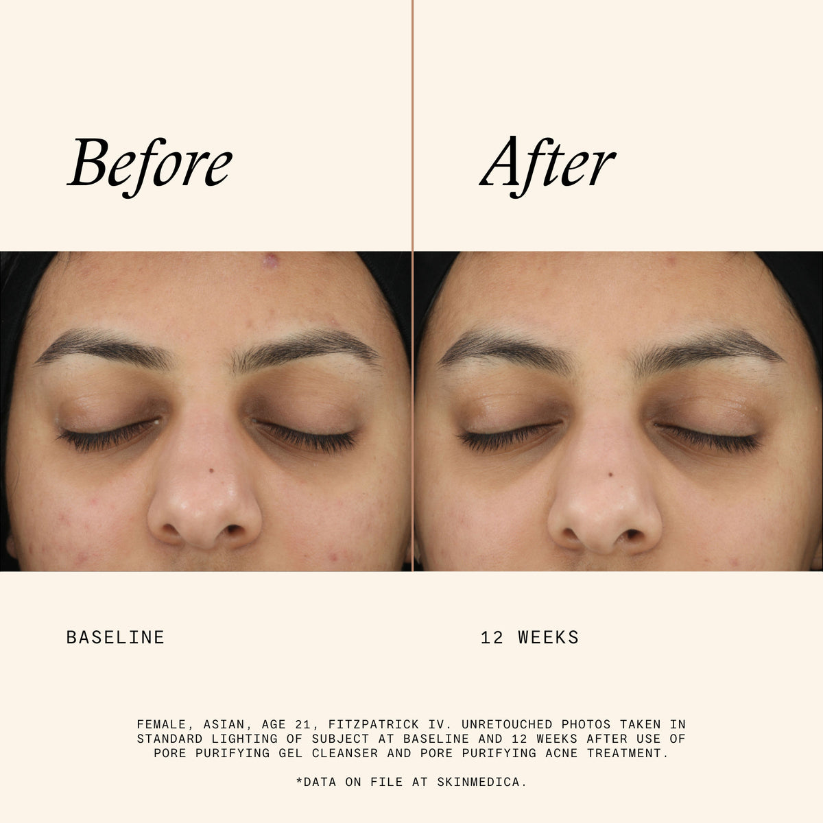Before and after results of using   variant: 2 fl oz