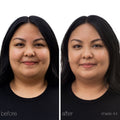 Before and after results of using RMS Beauty UnCoverup Concealer variant: 44