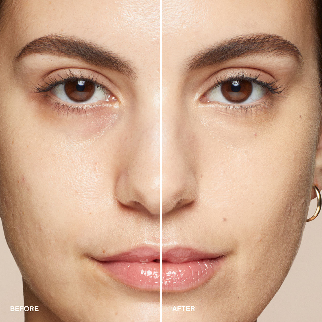 Before and after results of using Bobbi Brown Skin Concealer Stick variant: Beige