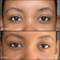 Before and after results of using RMS Beauty Revitalize Hydra Concealer variant: C017