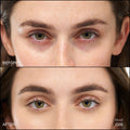 Before and after results of using RMS Beauty Revitalize Hydra Concealer variant: C06
