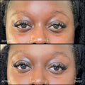 Before and after results of using RMS Beauty Revitalize Hydra Concealer variant: CN022