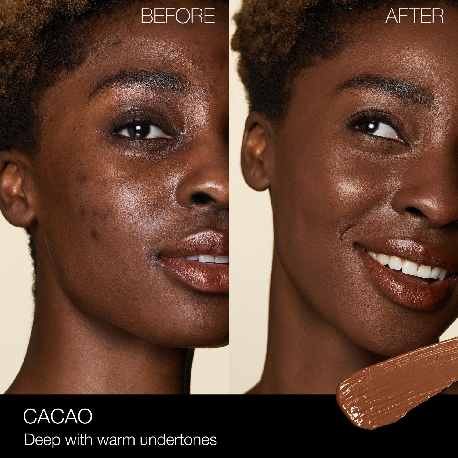 Before and after results of using Nars Radiant Creamy Concealer variant: Cacao D2