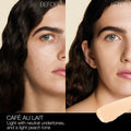 Before and after results of using Nars Radiant Creamy Concealer variant: Café Au Lait L2.4