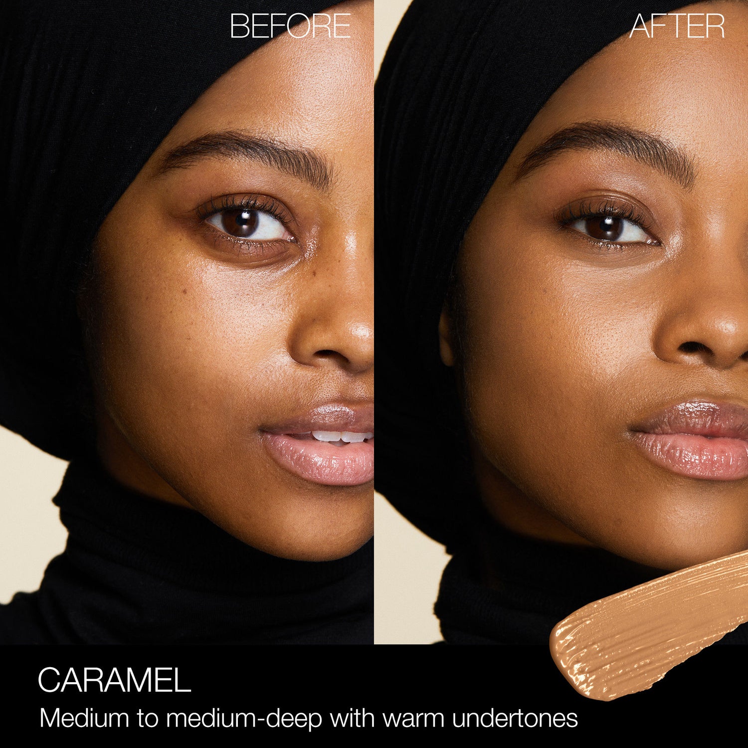 Before and after results of using Nars Radiant Creamy Concealer variant: Caramel MD2