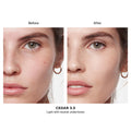 Before and after results of using Hourglass Vanish Airbrush Concealer variant: Cedar 3.5