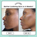 Before and after results of using   variant: Cream