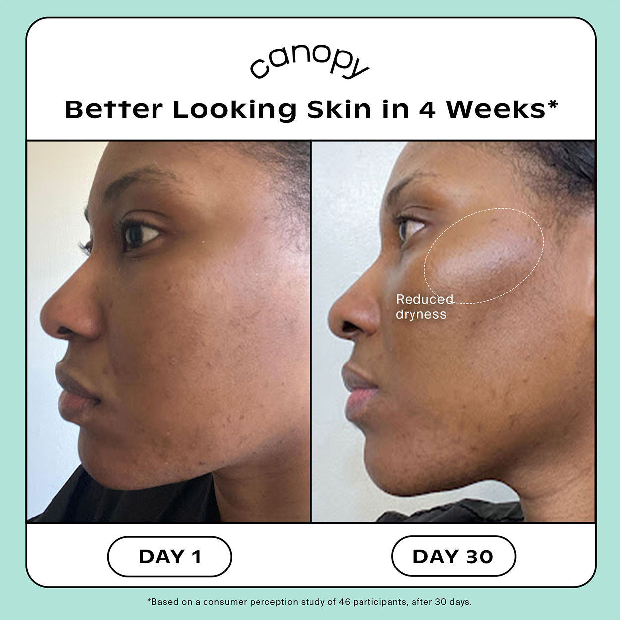 Before and after results of using   variant: Cream