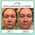Before and after results of using   variant: Cream