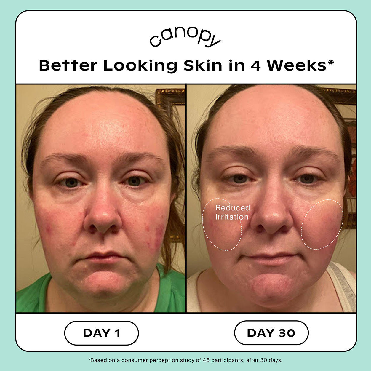 Before and after results of using   variant: Cream