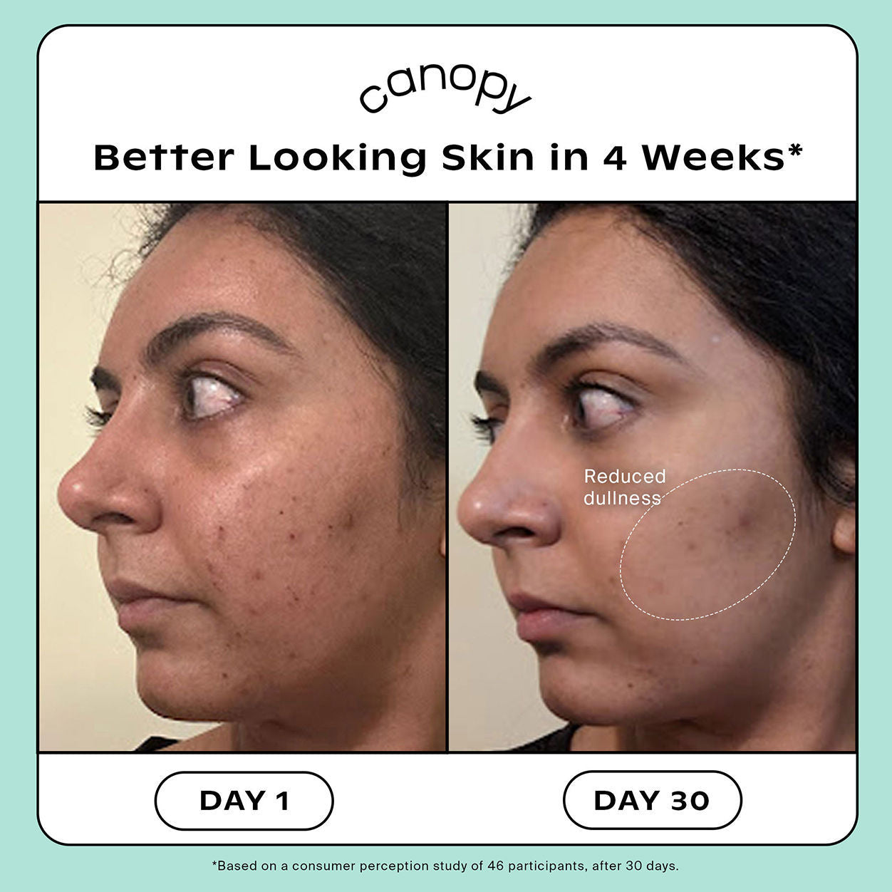 Before and after results of using   variant: Cream