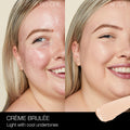 Before and after results of using Nars Radiant Creamy Concealer variant: Crème Brulée L2.5
