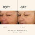 Before and after results of using   variant: 1 fl oz