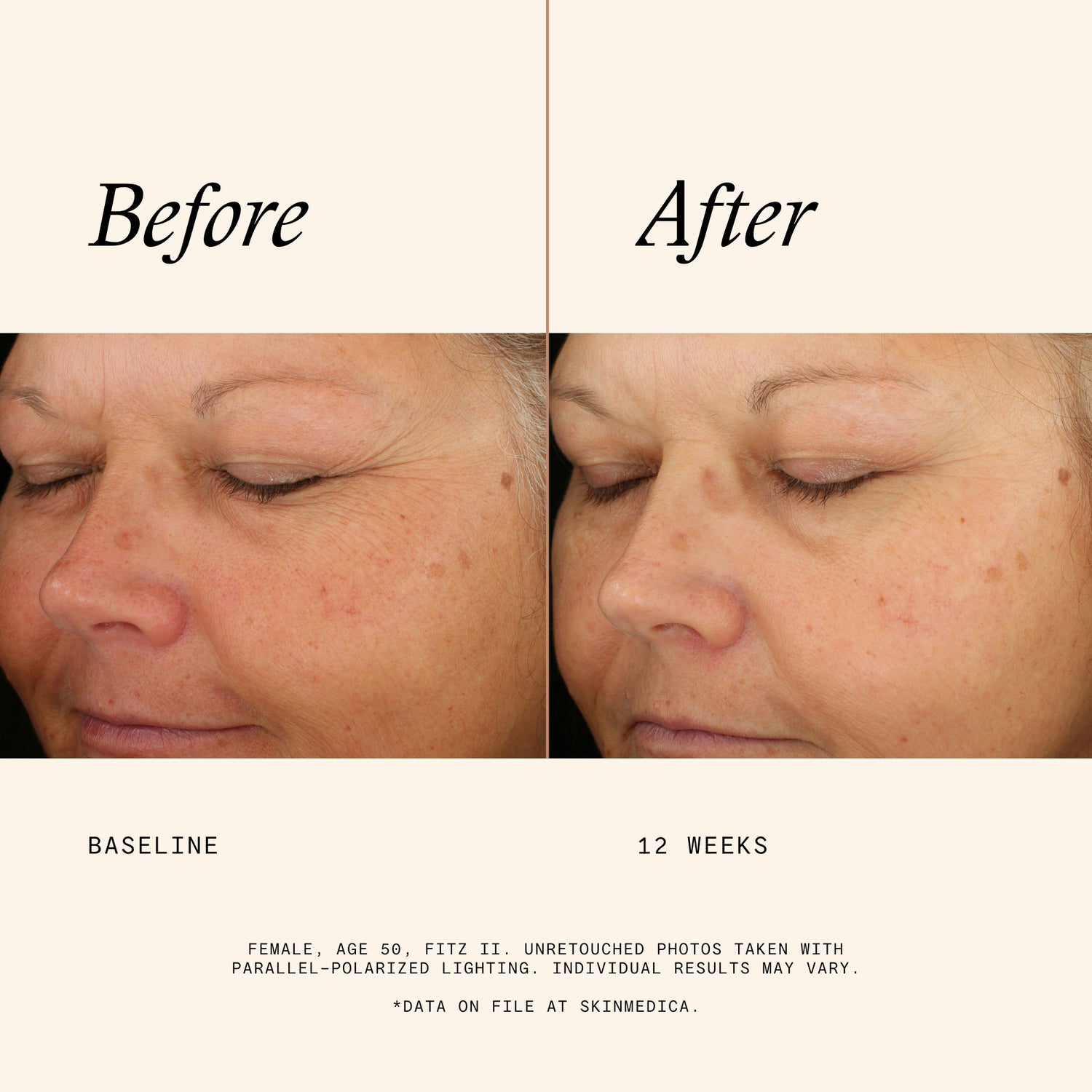 Before and after results of using   variant: 1 fl oz