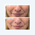 Before and after results of using   variant: Default Title
