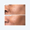 Before and after results of using   variant: Default Title