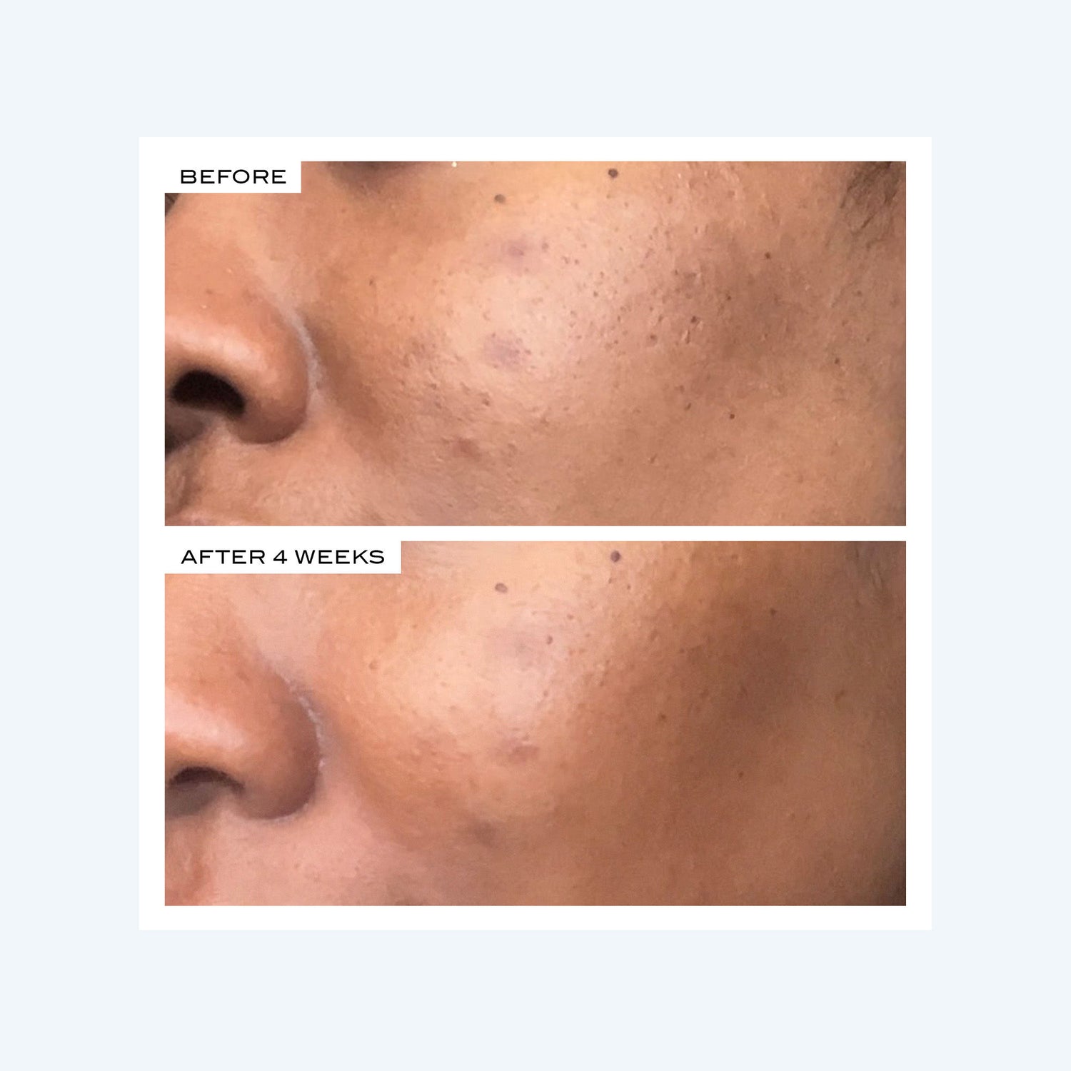 Before and after results of using   variant: Default Title