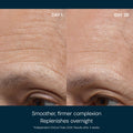 Before and after results of using   variant: Default Title