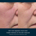 Before and after results of using   variant: Default Title