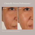 Before and After image. Clinically Proven Performance based on a consumer perception survey of 29 participants