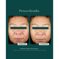 Before and after results of using   variant: Default Title