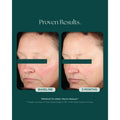 Before and after results of using   variant: Default Title