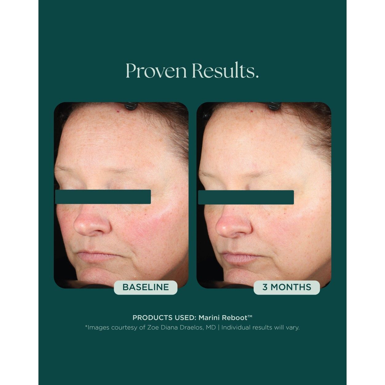Before and after results of using   variant: Default Title