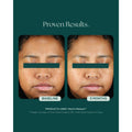 Before and after results of using   variant: Default Title