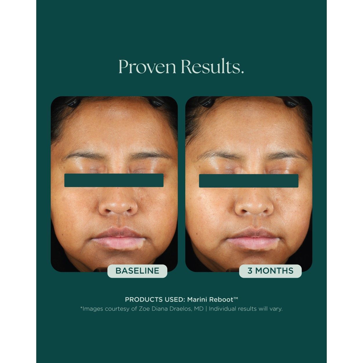 Before and after results of using   variant: Default Title