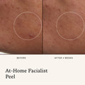Before and after results of using   variant: Default Title