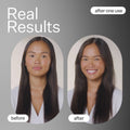 Before and after results of using Act+Acre Cold Processed Hair Cleanse Shampoo variant: 10 fl oz (Refill)