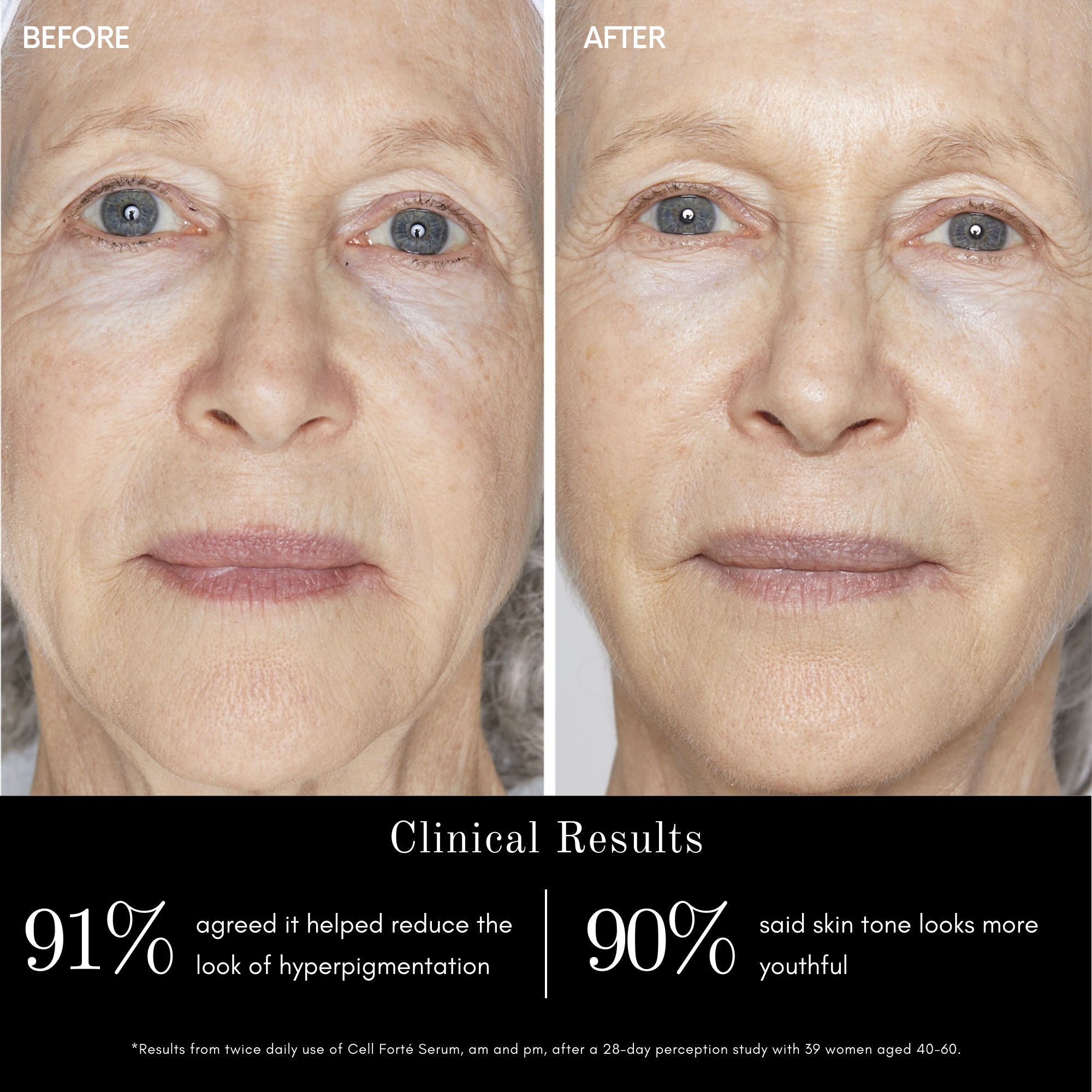 Angela Caglia Skincare Cell Forté Serum with BIOMSC™ – Angela