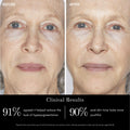 Before and after results of using   variant: Default Title