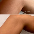 Before and after results of using   variant: Default Title