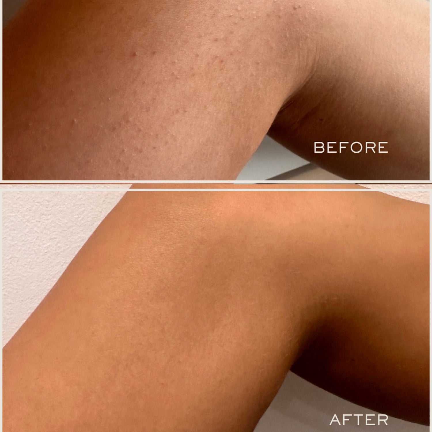 Before and after results of using   variant: Default Title