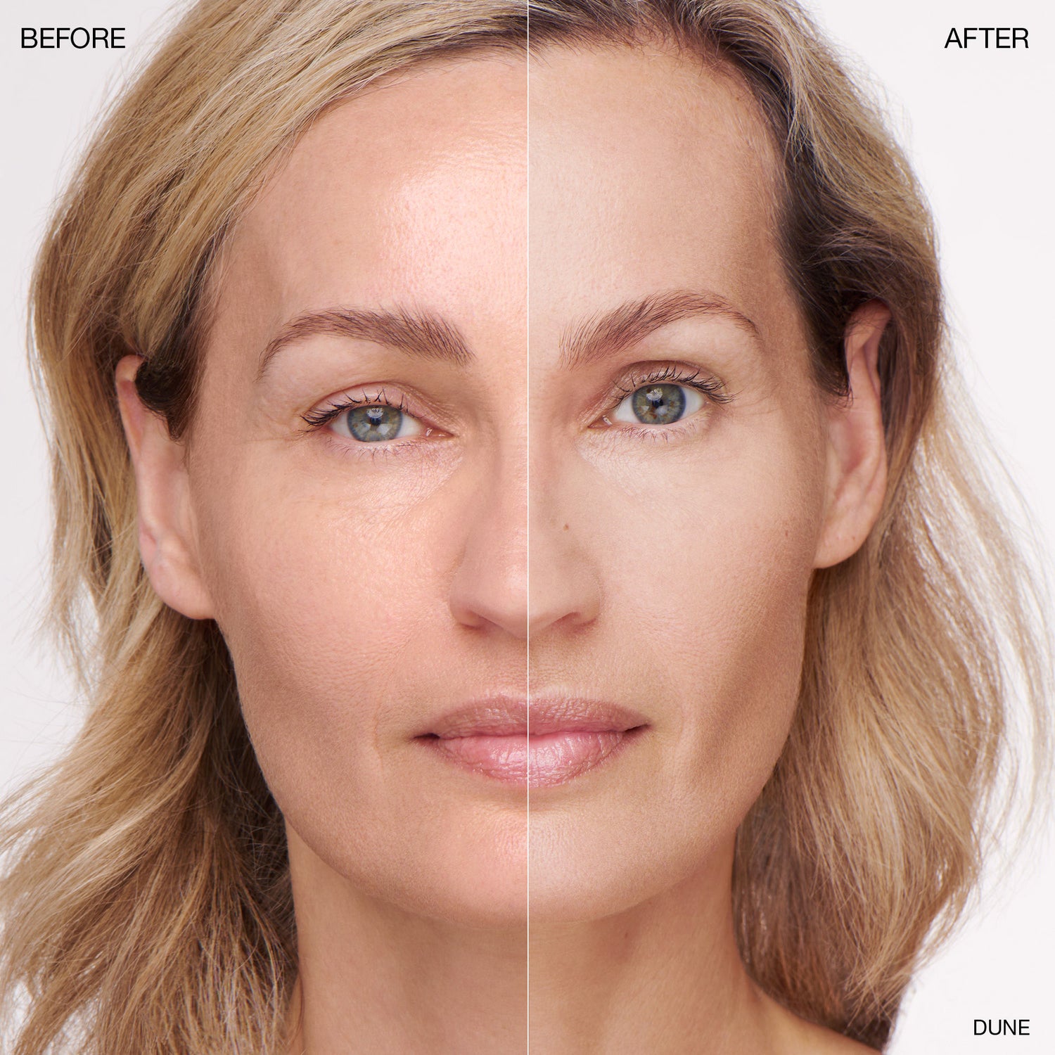 Before and after results of using   variant: Dune