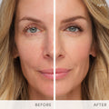 Before and after results of using Jane Iredale HydroPure Tinted Serum variant: Light 2