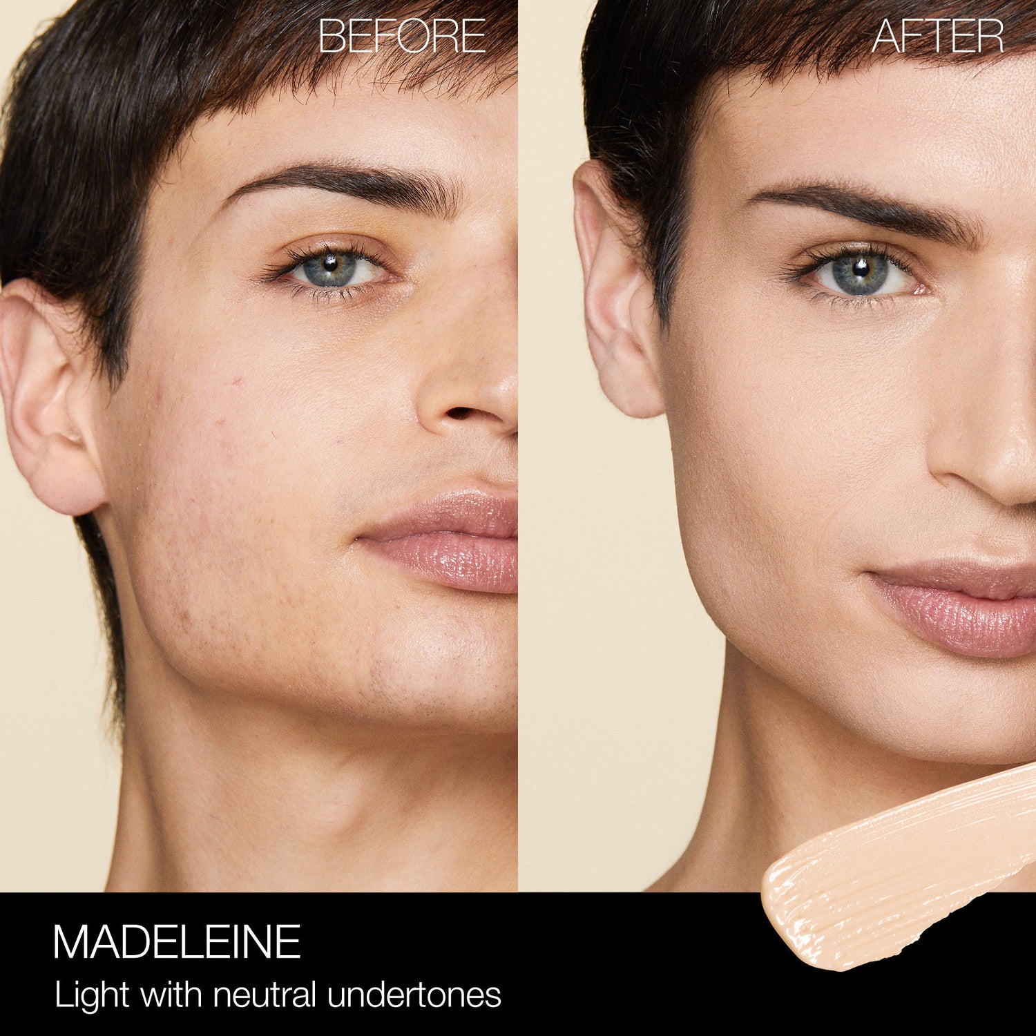 Before and after results of using Nars Radiant Creamy Concealer variant: Madeline L2.3