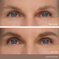 Before and after results of using   variant: Neutral Blonde